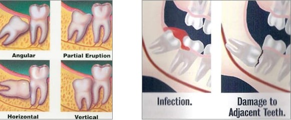 Wisdom Tooth Dental Clinic in Dhuri